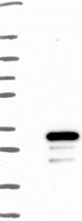 Western blot - Anti-FERDL3 antibody (AB126381)