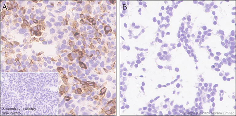 Immunohistochemistry (Formalin/PFA-fixed paraffin-embedded sections) - Anti-Ferredoxin, apicoplast antibody [EPR31001-512R] (AB325924)