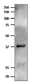 Western blot - Anti-Ferredoxin--NADP reductase, apicoplast antibody (AB243175)
