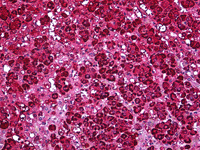 Immunohistochemistry (Formalin/PFA-fixed paraffin-embedded sections) - Anti-Ferredoxin Reductase antibody (AB122900), expandable thumbnail