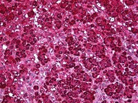 Immunohistochemistry (Formalin/PFA-fixed paraffin-embedded sections) - Anti-Ferredoxin Reductase antibody (AB122900)