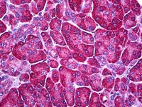 Immunohistochemistry (Formalin/PFA-fixed paraffin-embedded sections) - Anti-Ferredoxin Reductase antibody (AB122900)