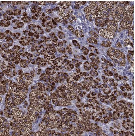 Immunohistochemistry (Formalin/PFA-fixed paraffin-embedded sections) - Anti-Ferredoxin Reductase antibody (AB204310)