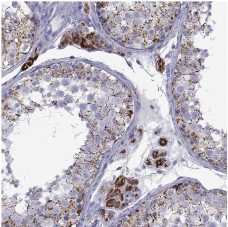 Immunohistochemistry (Formalin/PFA-fixed paraffin-embedded sections) - Anti-Ferredoxin Reductase antibody (AB204310)