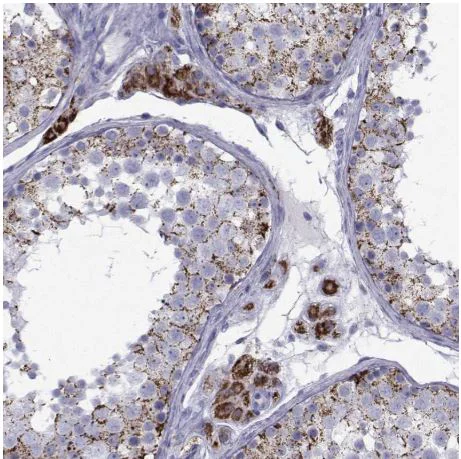 Immunohistochemistry (Formalin/PFA-fixed paraffin-embedded sections) - Anti-Ferredoxin Reductase antibody (AB204310)