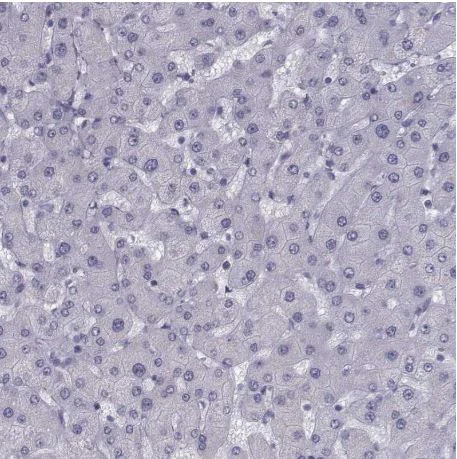 Immunohistochemistry (Formalin/PFA-fixed paraffin-embedded sections) - Anti-Ferredoxin Reductase antibody (AB204310)