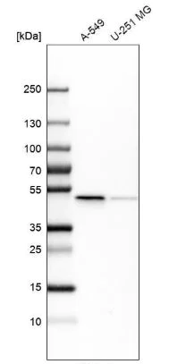 Western blot - Anti-Ferredoxin Reductase antibody (AB204310)