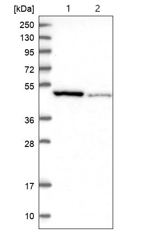 Western blot - Anti-Ferredoxin Reductase antibody (AB204310)
