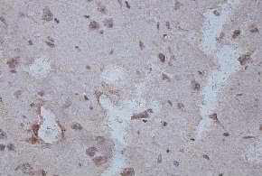 Immunohistochemistry (Formalin/PFA-fixed paraffin-embedded sections) - Anti-Ferritin antibody (AB124383)