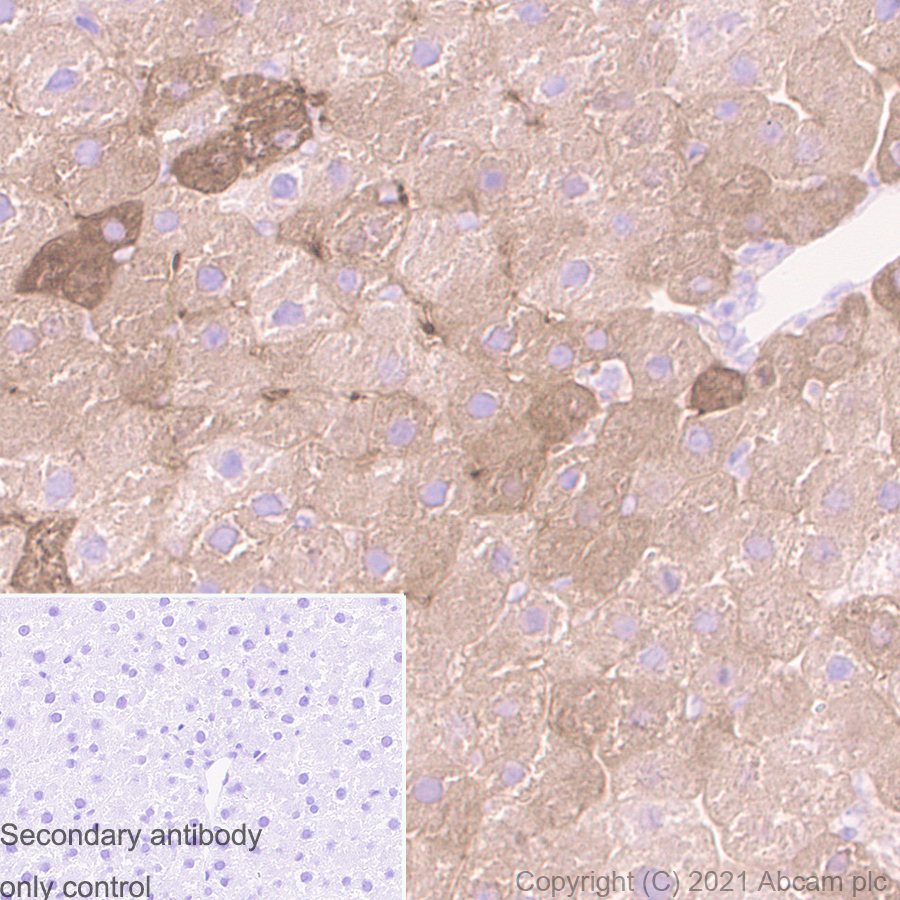 Immunohistochemistry (Formalin/PFA-fixed paraffin-embedded sections) - Anti-Ferritin antibody [RM1036] (ab287968), expandable thumbnail