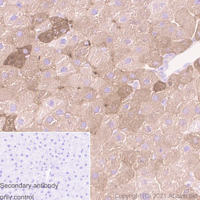 Immunohistochemistry (Formalin/PFA-fixed paraffin-embedded sections) - Anti-Ferritin antibody [RM1036] (AB287968)