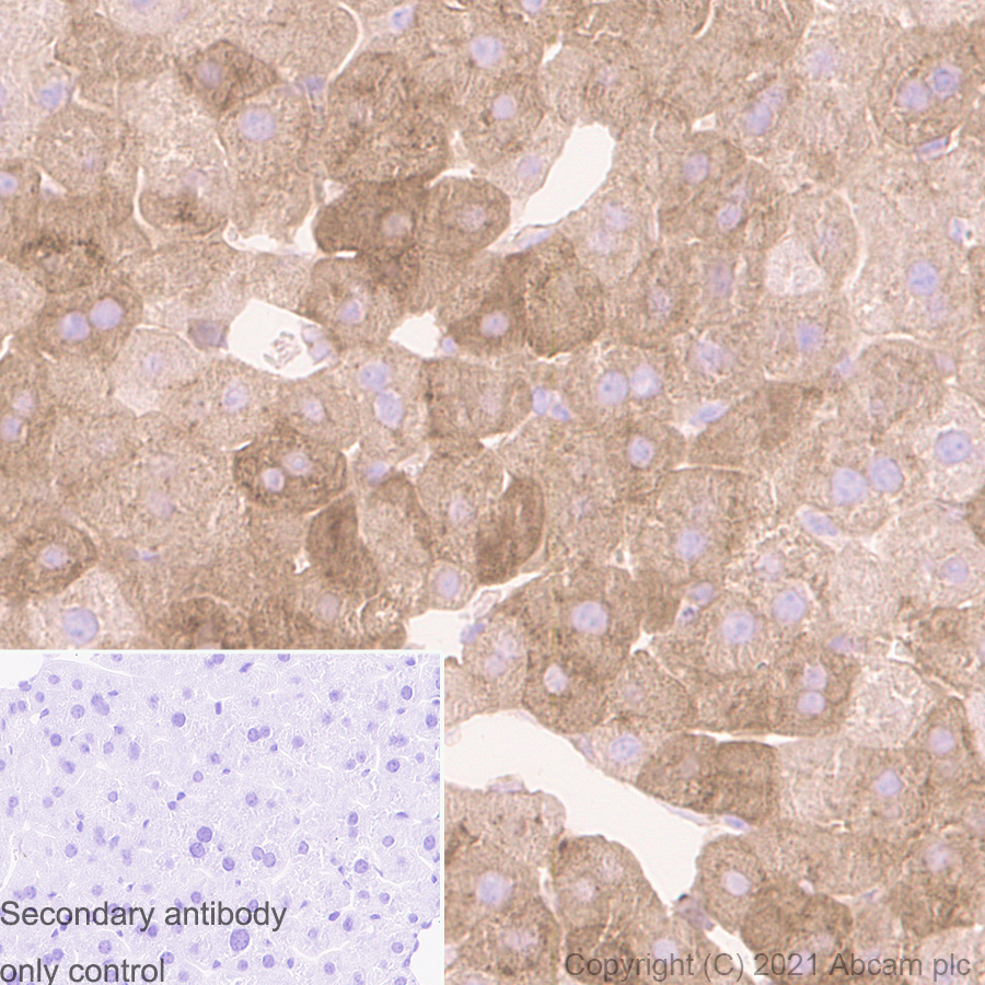 Immunohistochemistry (Formalin/PFA-fixed paraffin-embedded sections) - Anti-Ferritin antibody [RM1036] (AB287968), expandable thumbnail
