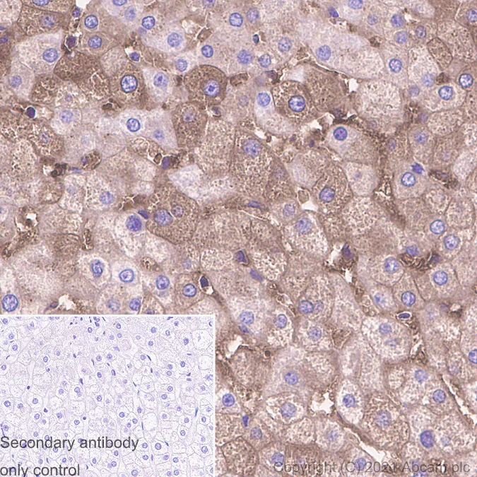 Immunohistochemistry (Formalin/PFA-fixed paraffin-embedded sections) - Anti-Ferritin antibody [RM1036] (AB287968)