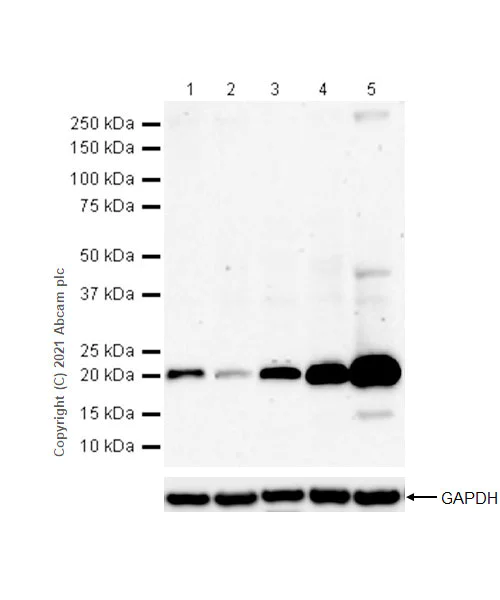 Western blot - Anti-Ferritin antibody [RM1036] (AB287968)