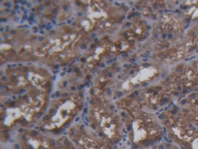 Immunohistochemistry (Formalin/PFA-fixed paraffin-embedded sections) - Anti-Ferritin Heavy Chain antibody (AB231253)