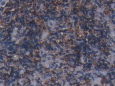 Immunohistochemistry (Formalin/PFA-fixed paraffin-embedded sections) - Anti-Ferritin Heavy Chain antibody (AB231253), expandable thumbnail