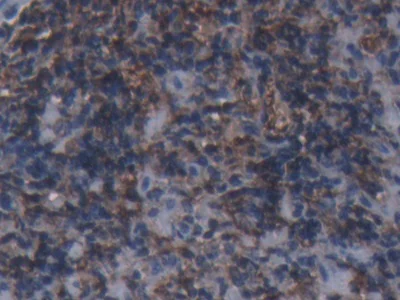 Immunohistochemistry (Formalin/PFA-fixed paraffin-embedded sections) - Anti-Ferritin Heavy Chain antibody (AB231253)