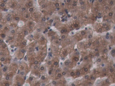 Immunohistochemistry (Formalin/PFA-fixed paraffin-embedded sections) - Anti-Ferritin Heavy Chain antibody (AB231253), expandable thumbnail