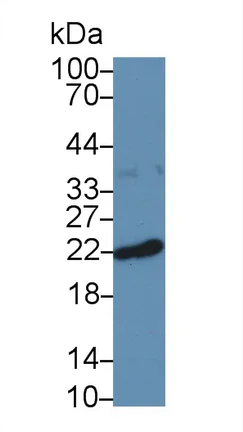 Western blot - Anti-Ferritin Heavy Chain antibody (AB231253)
