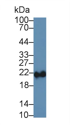 Western blot - Anti-Ferritin Heavy Chain antibody (AB231253)