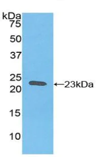 Western blot - Anti-Ferritin Heavy Chain antibody (AB231253)