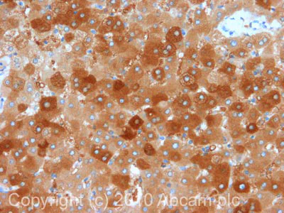 Immunohistochemistry (Formalin/PFA-fixed paraffin-embedded sections) - Anti-Ferritin Heavy Chain antibody (AB65080)