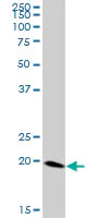 Western blot - Anti-Ferritin Heavy Chain antibody (AB89787)
