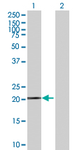 Western blot - Anti-Ferritin Heavy Chain antibody (AB89787)