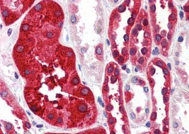Immunohistochemistry (Formalin/PFA-fixed paraffin-embedded sections) - Anti-Ferritin Heavy Chain antibody - C-terminal (AB188771)