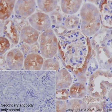 Immunohistochemistry (Formalin/PFA-fixed paraffin-embedded sections) - Anti-Ferritin Heavy Chain antibody [EPR18878] - BSA and Azide free (AB240277)