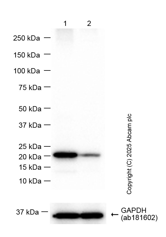 Western blot - Anti-Ferritin heavy chain antibody [EPR3004Y] (ab75973), expandable thumbnail