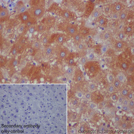 Immunohistochemistry (Formalin/PFA-fixed paraffin-embedded sections) - Anti-Ferritin Heavy Chain antibody [EPR3005Y] (AB75972)