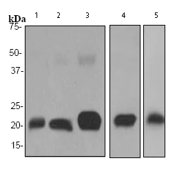 Western blot - Anti-Ferritin Heavy Chain antibody [EPR3005Y] (AB75972)
