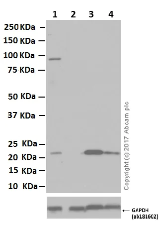 Western blot - Anti-Ferritin Heavy Chain antibody [EPR3005Y] (AB75972)