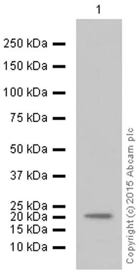 Western blot - Anti-Ferritin Heavy Chain antibody [EPR3005Y] (AB75972)