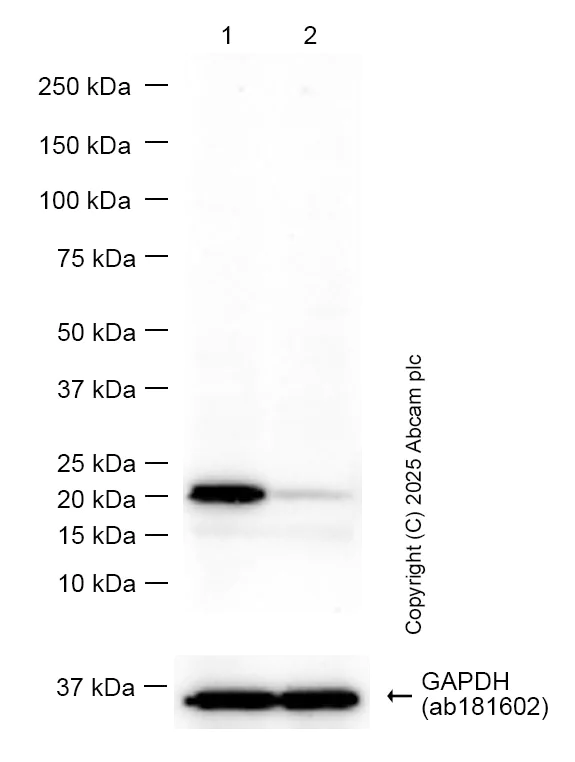 Western blot - Anti-Ferritin Heavy Chain antibody [EPR3005Y] (AB75972)