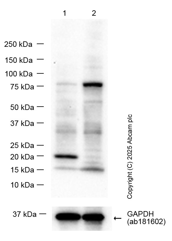 Western blot - Anti-Ferritin Heavy Chain antibody [EPR3005Y] (ab75972), expandable thumbnail