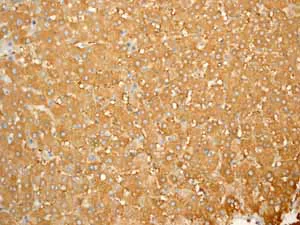 Immunohistochemistry (Formalin/PFA-fixed paraffin-embedded sections) - Anti-Ferritin Heavy Chain antibody [EPR3005Y] - BSA and Azide free (AB247418)