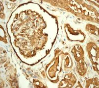 Immunohistochemistry (Formalin/PFA-fixed paraffin-embedded sections) - Anti-Ferritin Heavy Chain antibody [EPR3005Y] - BSA and Azide free (AB247418)