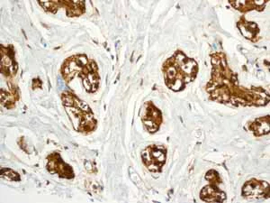 Immunohistochemistry (Formalin/PFA-fixed paraffin-embedded sections) - Anti-Ferritin Heavy Chain antibody [EPR3005Y] - BSA and Azide free (AB247418)
