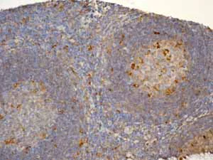 Immunohistochemistry (Formalin/PFA-fixed paraffin-embedded sections) - Anti-Ferritin Heavy Chain antibody [EPR3005Y] - BSA and Azide free (AB247418)