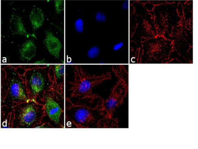 Immunocytochemistry/ Immunofluorescence - Anti-Ferritin Heavy Chain antibody [RP23040130] (AB308115), expandable thumbnail