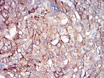 Immunohistochemistry (Formalin/PFA-fixed paraffin-embedded sections) - Anti-Ferritin Light Chain antibody [8E1E7] (AB201975), expandable thumbnail