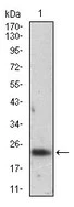 Western blot - Anti-Ferritin Light Chain antibody [8E1E7] (AB201975)