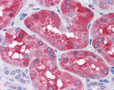 Immunohistochemistry (Formalin/PFA-fixed paraffin-embedded sections) - Anti-Ferritin Light Chain antibody (AB110017)