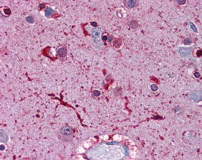 Immunohistochemistry (Formalin/PFA-fixed paraffin-embedded sections) - Anti-Ferritin Light Chain antibody (AB110017)