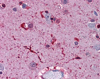 Immunohistochemistry (Formalin/PFA-fixed paraffin-embedded sections) - Anti-Ferritin Light Chain antibody (AB110017)