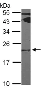 Western blot - Anti-Ferritin Light Chain antibody (AB153976)