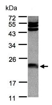 Western blot - Anti-Ferritin Light Chain antibody (AB153976)