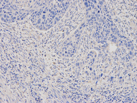 Immunohistochemistry (Formalin/PFA-fixed paraffin-embedded sections) - Anti-Ferritin Light Chain antibody (AB186871)